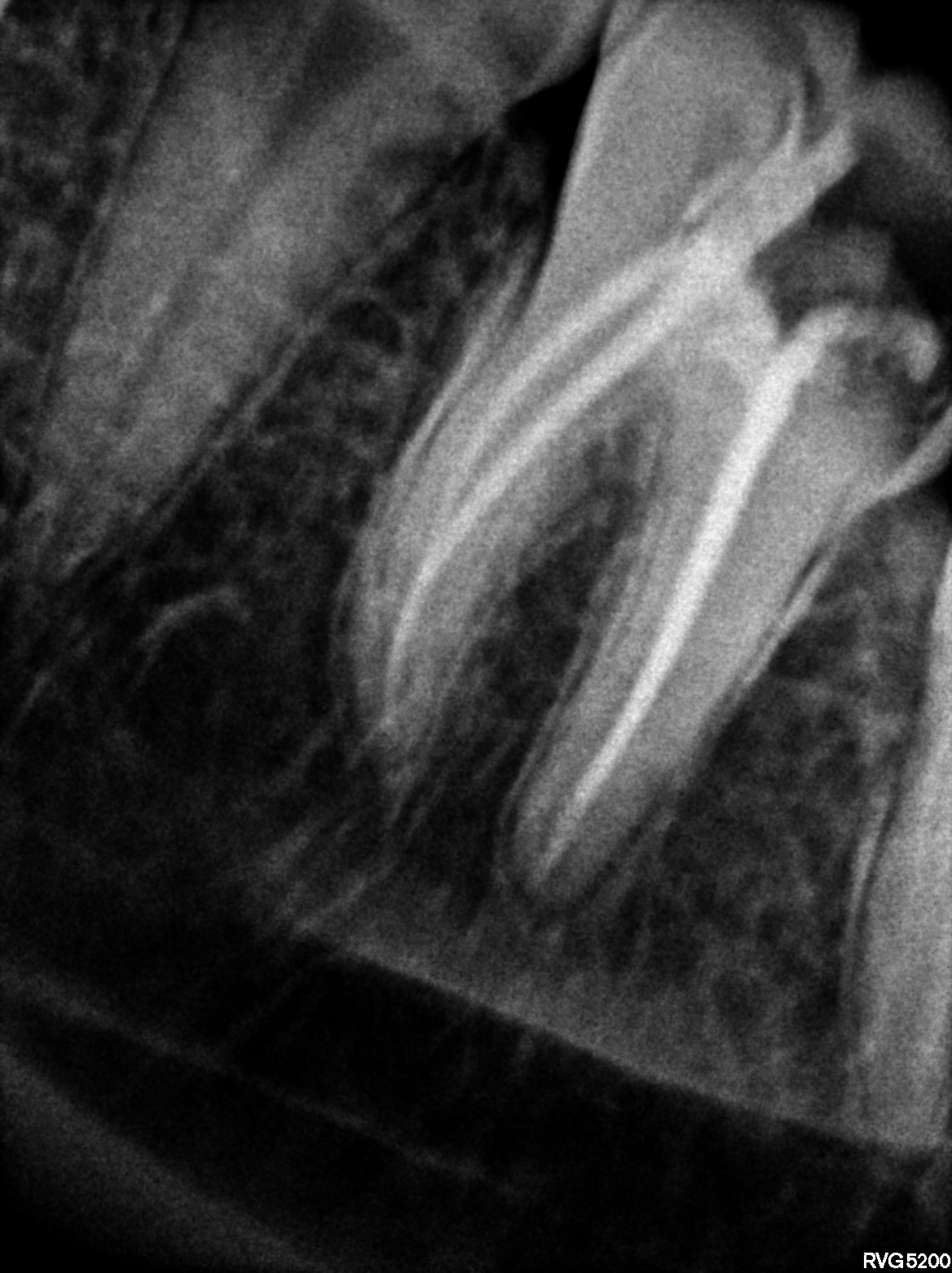 Dental X-ray